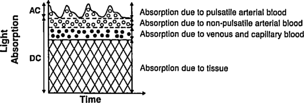 AC and DC transmission components